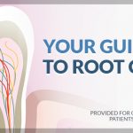 Your Guide to Root Canals